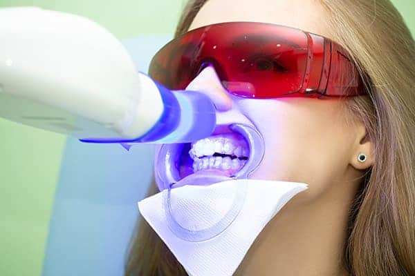 Laser teeth whitening treatments Tamworth