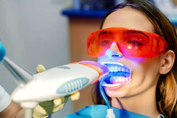 Simplifying Teeth Whitening: A Comprehensive Guide Tamworth