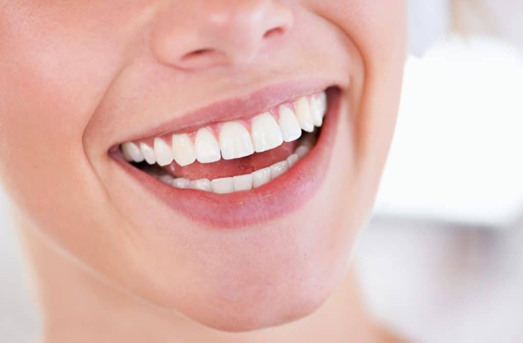 Teeth Whitening West Drayton Tamworth