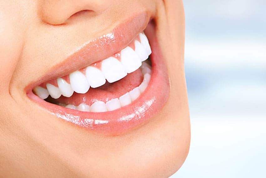 Teeth Whitening Abingdon Tamworth