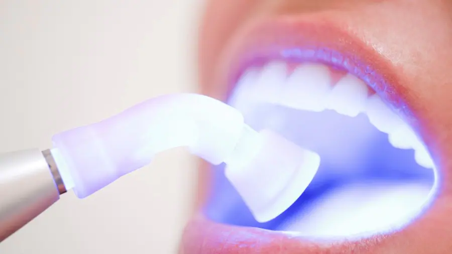 Teeth Whitening Aylesbury Tamworth