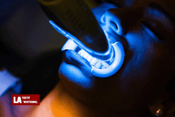 Is Laser Whitening Bad For You? Tamworth