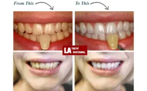 I Don't Want My Teeth Too White Tamworth