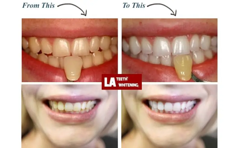 I Don't Want My Teeth Too White Tamworth