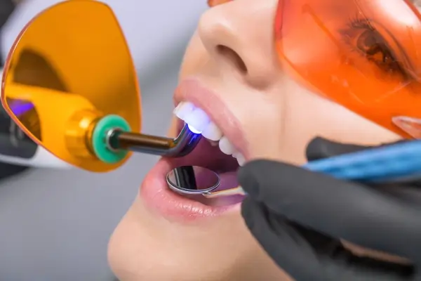Relaxed woman receiving safe Laser Teeth Whitening for discoloured teeth Tamworth